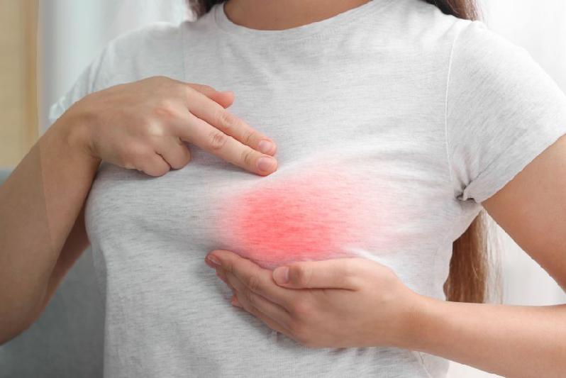Breast Pain
